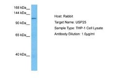 USP25 Rabbit anti-Human, Polyclonal, Novus Biologicals 0.1 mL | Buy Online | Novus Biologicals | Fisher Scientific